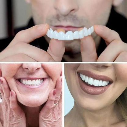 Snap on Smile