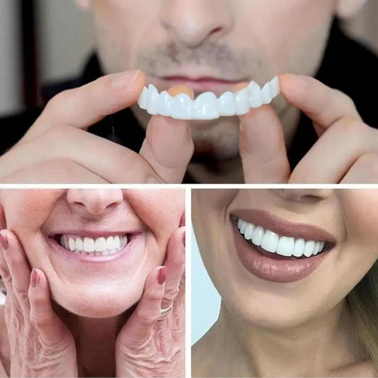 Snap on Smile