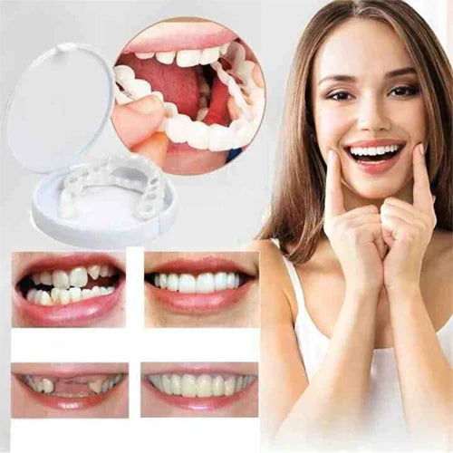 Snap on Smile