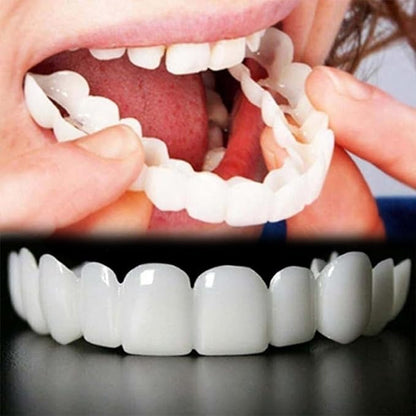 Snap on Smile